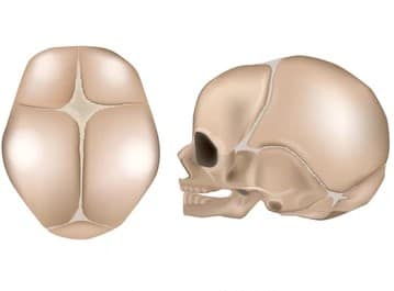 Fontanelles du nourrisson